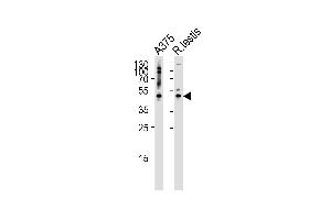 Western blot analysis of lysates from A375 cell line and rat testis tissue lysate(from left to right), using AP1M1 Antibody at 1:1000 at each lane.