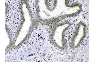 IHC analysis of Cdc20 using anti-Cdc20 antibody .