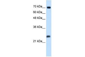Human Placenta; WB Suggested Anti-SERTAD1 Antibody Titration: 0. (SERTAD1 anticorps  (N-Term))