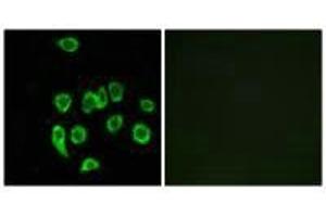 Immunofluorescence analysis of A549 cells, using MRPL32 antibody. (MRPL32 anticorps)