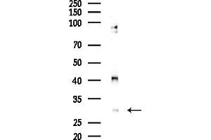 anti-PHD Finger Protein 11 (PHF11) (C-Term) antibody