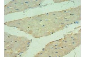 Immunohistochemistry of paraffin-embedded human skeletal muscle tissue using ABIN7144121 at dilution of 1:100 (ANGPTL4 anticorps  (AA 26-406))