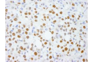 Immunohistochemistry (IHC) image for anti-Activity-Dependent Neuroprotector Homeobox (ADNP) (C-Term) antibody (ABIN7448403) (ADNP anticorps  (C-Term))