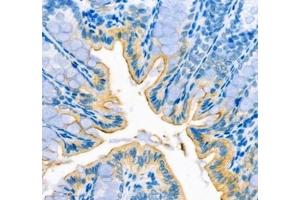 Immunohistochemistry of paraffin embedded mouse colon using ATP1HC1 (ABIN7073160) at dilution of 1:500 (400x lens)