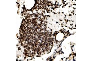 IHC analysis of RCC1 using anti-RCC1 antibody (ABIN7600024). (RCC1 anticorps  (AA 14-421))