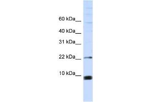WB Suggested Anti-SNRPF Antibody Titration:  0. (SNRPF anticorps  (Middle Region))
