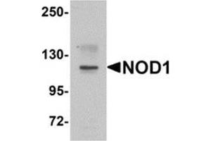 Western blot analysis of NOD1 in EL4 cell lysate with NOD1 antibody at 1 μg/ml. (NOD1 anticorps  (C-Term))
