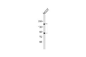Anti-Sall4 Antibody (C-term)at 1:1000 dilution + NCCIT whole cell lysates Lysates/proteins at 20 μg per lane. (SALL4 anticorps  (C-Term))