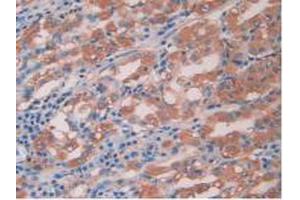 IHC-P analysis of Human Stomach Tissue, with DAB staining. (IL-15 anticorps  (AA 50-162))