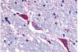Anti-TACR3 antibody  ABIN1049392 IHC staining of human brain, hippocampus. (TACR3 anticorps  (C-Term))
