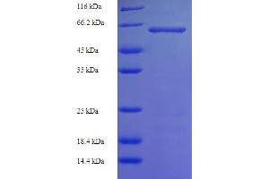 SDS-PAGE (SDS) image for serine/threonine Kinase 25 (STK25) (AA 1-426), (full length) protein (His-SUMO Tag) (ABIN5710428)