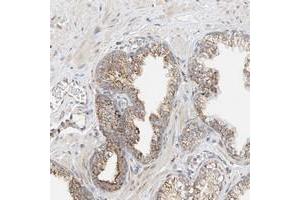 Immunohistochemical staining of human prostate with YIPF7 polyclonal antibody  shows moderate cytoplasmic positivity with a granular pattern in glandular cells. (YIPF7 anticorps)