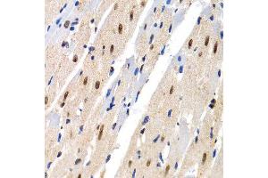 Immunohistochemistry of paraffin-embedded rat heart using MT2A antibody at dilution of 1:200 (400x lens). (MT2A anticorps)