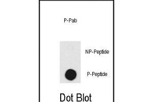 Dot blot analysis of anti-DNA-PK-p Pab (R) on nitrocellulose membrane. (PRKDC anticorps  (pThr2609))