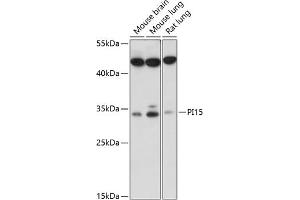 Western blot analysis of extracts of various cell lines, using PI15 antibody (ABIN7269205) at 1:1000 dilution.