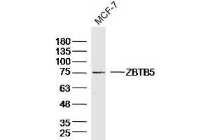 MCF-7 Cell lysates probed with ZBTB5 Polyclonal Antibody, unconjugated  at 1:300 overnight at 4°C followed by a conjugated secondary antibody for 60 minutes at 37°C. (ZBTB5 anticorps  (AA 581-677))