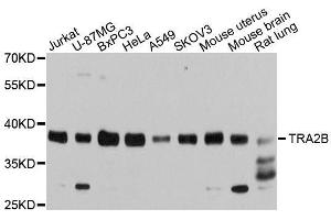 Western blot analysis of extracts of various cell lines, using TRA2B antibody. (TRA2B anticorps)