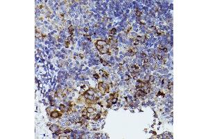 Immunohistochemistry of paraffin-embedded mouse spleen using THBS1 Rabbit pAb (ABIN3022978, ABIN3022979, ABIN3022980 and ABIN6219329) at dilution of 1:50 (40x lens).