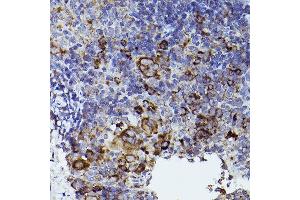 Immunohistochemistry of paraffin-embedded mouse spleen using THBS1 Rabbit pAb (ABIN3022978, ABIN3022979, ABIN3022980 and ABIN6219329) at dilution of 1:50 (40x lens). (Thrombospondin 1 anticorps  (AA 80-360))