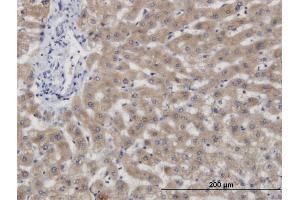 Immunoperoxidase of monoclonal antibody to CBS on formalin-fixed paraffin-embedded human liver. (CBS anticorps  (AA 1-100))