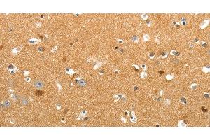 Immunohistochemistry of paraffin-embedded Human brain tissue using TNR Polyclonal Antibody at dilution 1:60