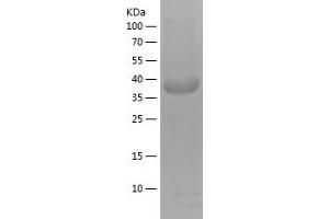 Western Blotting (WB) image for Granulin (GRN) (AA 289-426) protein (His-IF2DI Tag) (ABIN7123192)