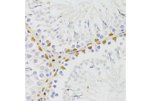 Immunohistochemistry of paraffin-embedded rat testis using EL antibody (ABIN6132052, ABIN6140108, ABIN6140109 and ABIN6222942) at dilution of 1:200 (40x lens). (ELAC2 anticorps  (AA 1-270))