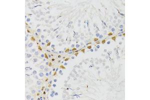 Immunohistochemistry of paraffin-embedded rat testis using EL antibody (ABIN6132052, ABIN6140108, ABIN6140109 and ABIN6222942) at dilution of 1:200 (40x lens). (ELAC2 anticorps  (AA 1-270))