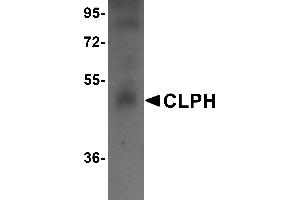 Western Blotting (WB) image for anti-Calcium-Binding Protein, Spermatid-Specific 1 (CABS1) (C-Term) antibody (ABIN1030341) (CABS1 anticorps  (C-Term))
