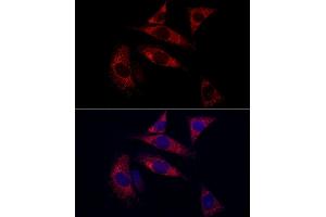Immunofluorescence analysis of NIH/3T3 cells using SURF4 Rabbit pAb (ABIN7270650) at dilution of 1:100 (40x lens). (Surfeit 4 anticorps  (AA 50-150))