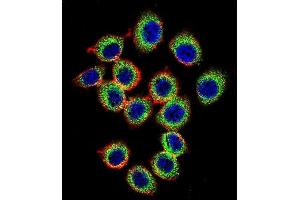 Confocal immunofluorescent analysis of RASGRP2 Antibody (N-term) (ABIN656117 and ABIN2845456) with U-251MG cell followed by Alexa Fluor 488-conjugated goat anti-rabbit lgG (green).