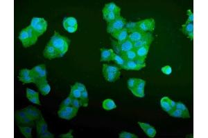 IF analysis of Aldolase/ALDOA using anti-Aldolase/ALDOA antibody (ABIN7601908). (ALDOA anticorps  (AA 50-364))