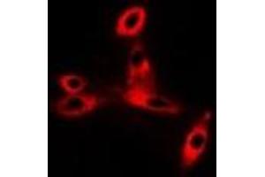Immunofluorescent analysis of CD47 staining in Hela cells. (CD47 anticorps)