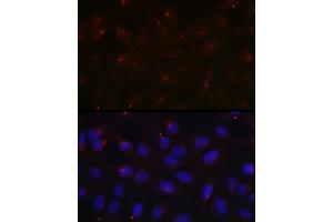 Immunofluorescence analysis of U2OS cells using PCM1 Rabbit pAb  at dilution of 1:100 (40x lens). (PCM1 anticorps  (AA 1-260))