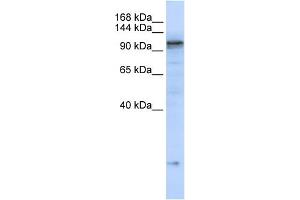WB Suggested Anti-ATP2A2 Antibody Titration:  0. (ATP2A2 anticorps  (C-Term))