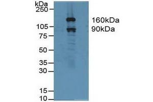 Detection of GSN in Human Hela Cells using Polyclonal Antibody to Gelsolin (GSN)