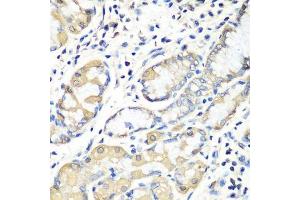 Immunohistochemistry of paraffin-embedded human stomach using EZR antibody.