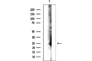 anti-Chromosome 12 Open Reading Frame 53 (C12orf53) antibody