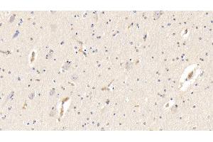 Detection of AHSG in Bovine Cerebrum Tissue using Polyclonal Antibody to Alpha-2-Heremans Schmid Glycoprotein (AHSG)