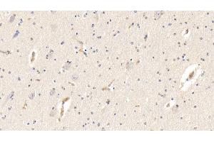 Detection of AHSG in Bovine Cerebrum Tissue using Polyclonal Antibody to Alpha-2-Heremans Schmid Glycoprotein (AHSG) (Fetuin A anticorps  (AA 19-359))