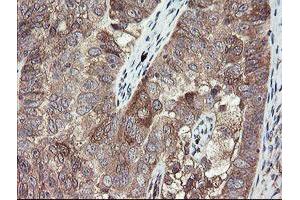 Image no. 11 for anti-TSC22 Domain Family, Member 1 (TSC22D1) antibody (ABIN1501535) (TSC22D1 anticorps)