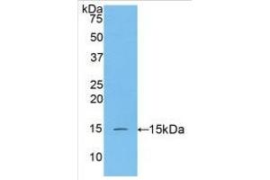 WB of Protein Standard: different control antibodies against Highly purified E.