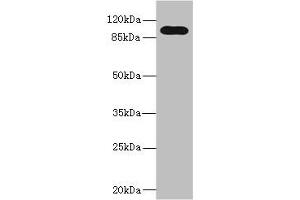 Western blot All lanes: TLR6 antibody at 5 μg/mL + Jurkat whole cell lysate Secondary Goat polyclonal to rabbit IgG at 1/10000 dilution Predicted band size: 92, 56 kDa Observed band size: 92 kDa (TLR6 anticorps  (AA 32-586))
