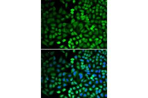 Immunofluorescence analysis of HeLa cells using APEX1 antibody.
