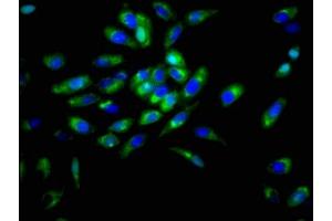 Immunofluorescence staining of Hela cells with ABIN7149787 at 1:166, counter-stained with DAPI. (Desmoglein 3 anticorps  (AA 70-615))