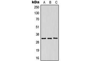 Western blot analysis of CD158g expression in HeLa (A), SP2/0 (B), NIH3T3 (C) whole cell lysates. (KIR2DS5 anticorps  (Center))