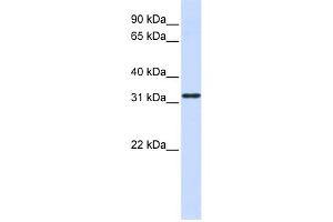 WB Suggested Anti-NANOS1 Antibody Titration:  0. (Nanos Homolog 1 anticorps  (Middle Region))