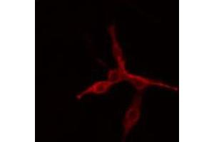 ABIN6272344 staining COLO205 cells by IF/ICC. (MAP4K6 anticorps  (Internal Region))