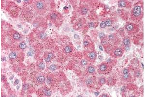 Human Liver (formalin-fixed, paraffin-embedded) stained with MPP6 antibody ABIN337016 at 5 ug/ml followed by biotinylated anti-goat IgG secondary antibody ABIN481715, alkaline phosphatase-streptavidin and chromogen. (MPP6 anticorps  (AA 2-14))