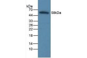 Detection of ICAM1 in Rat Liver Tissue using Polyclonal Antibody to Intercellular Adhesion Molecule 1 (ICAM1) (ICAM1 anticorps  (AA 41-464))